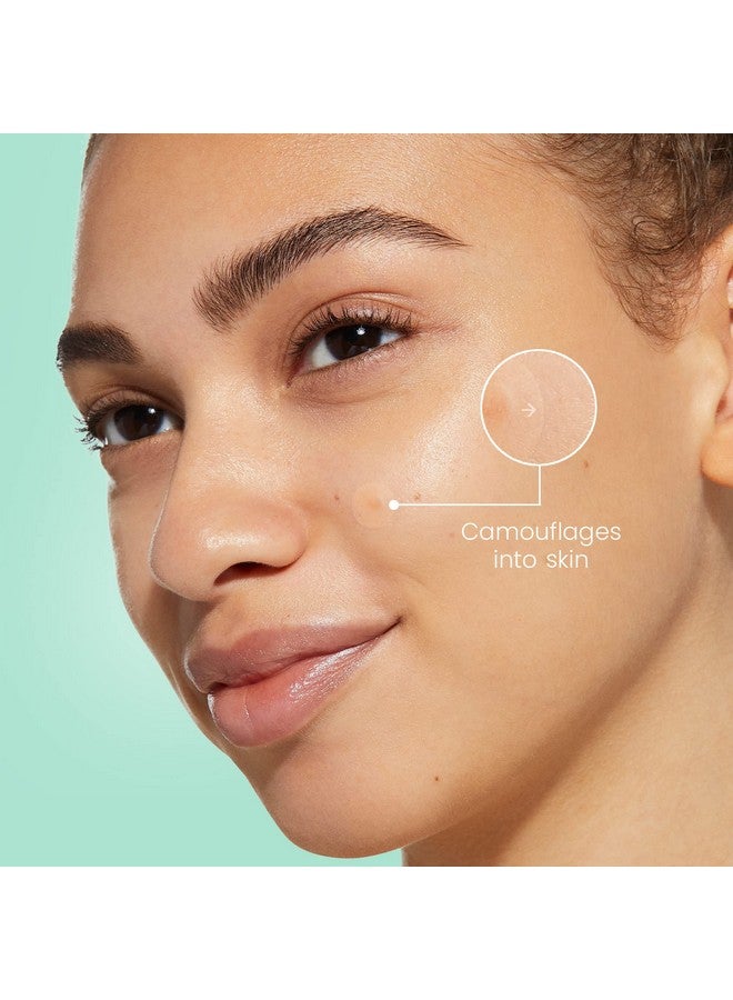 JOAH Heal Me Cica Spot Patch Hydrocolloid Korean Skin Care Spot Patches With Centella Asiatica 30 Patches White - Image 2