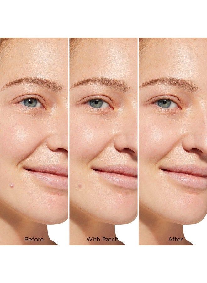 JOAH Heal Me Cica Spot Patch Hydrocolloid Korean Skin Care Spot Patches With Centella Asiatica 30 Patches White - Image 3