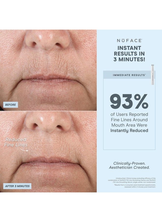 Nuface FIX Line Smoothing Starter Kit - FDA Cleared Microcurrent Device + Serum Activator for On-The-Go Treatment of Forehead Lines, Crow's Feet, Under Eyes, Smile & Fuller-Looking Lips  - Image 2