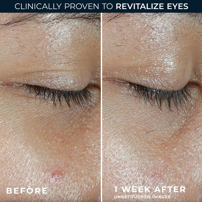 RoC بلسم العين فيتامين سي من روك مالتي كوركسيون ريفيف + جلو (0.14 أونصة) مع عينة كريم العين ريتينول - Image 4