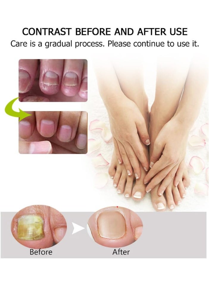 EELHOE Nail Treatment Repair Gel, Toe Be Health Instant Beauty Gel, Narc Nail Care, Narc Nail Treatment Repair Gel - Image 5