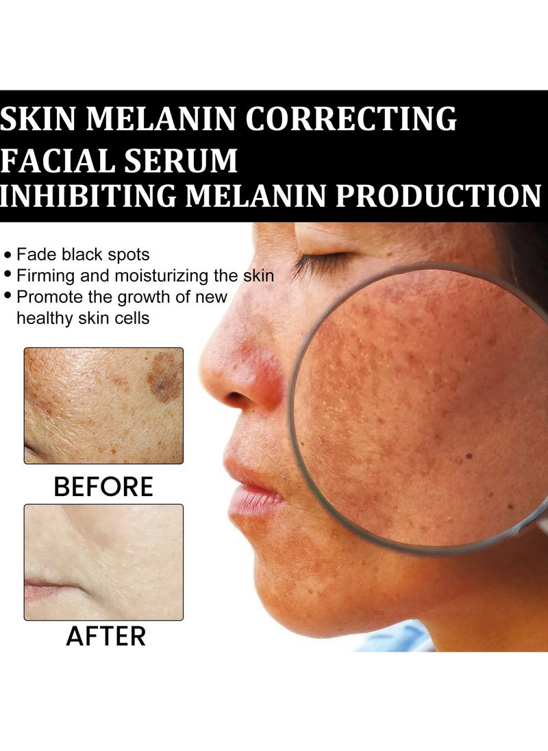 EELHOE - Melanin Correcting Facial Serum, Dark Spot Correcting Glow Serum, Anti-aging Facial Serum, Whitening Niacinamide Facial Essence For Skin Brightness, Dark Spot Removal And Moisturizing Skin - Image 1
