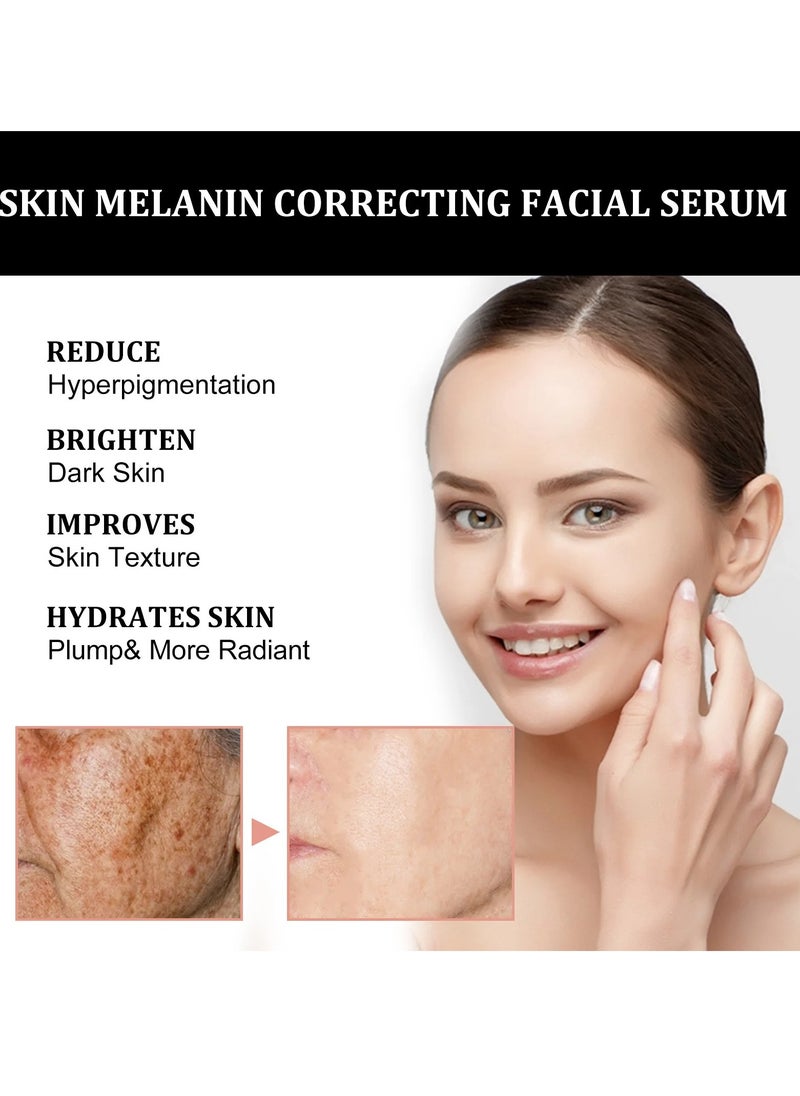 EELHOE - Melanin Correcting Facial Serum, Dark Spot Correcting Glow Serum, Anti-aging Facial Serum, Whitening Niacinamide Facial Essence For Skin Brightness, Dark Spot Removal And Moisturizing Skin - Image 1