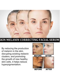 EELHOE Melanin Correcting Facial Serum, Dark Spot Correcting Glow Serum, Anti-aging Facial Serum, Whitening Niacinamide Facial Essence For Skin Brightness, Dark Spot Removal And Moisturizing Skin  - Image 3