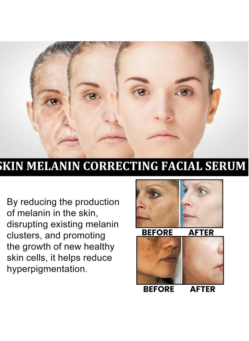 EELHOE - Melanin Correcting Facial Serum, Dark Spot Correcting Glow Serum, Anti-aging Facial Serum, Whitening Niacinamide Facial Essence For Skin Brightness, Dark Spot Removal And Moisturizing Skin - Image 1