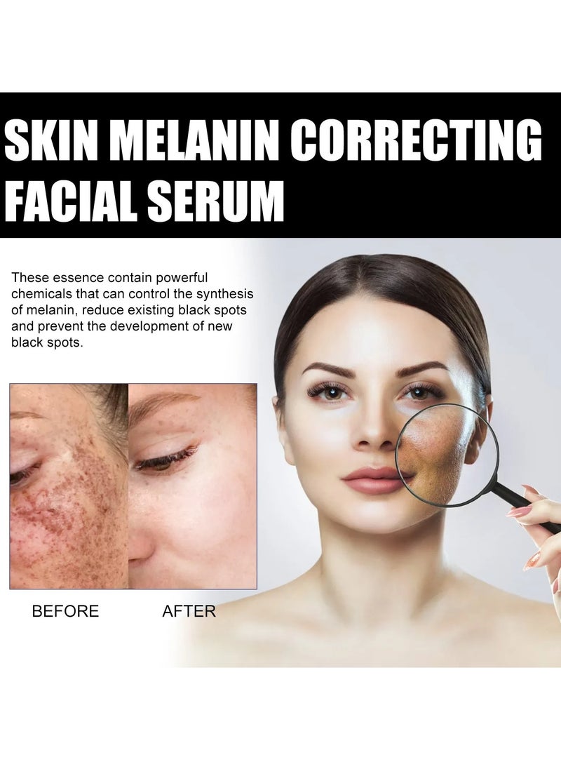 EELHOE - Melanin Correcting Facial Serum, Dark Spot Correcting Glow Serum, Anti-aging Facial Serum, Whitening Niacinamide Facial Essence For Skin Brightness, Dark Spot Removal And Moisturizing Skin - Image 1