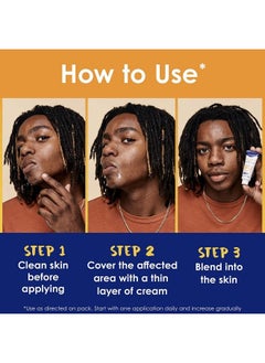 Clearasil Stubborn Acne Control 5In1 Spot Treatment Cream Maximum Strenght With 10% Benzoyl Peroxide Acne Medication 1 Oz  - Image 5