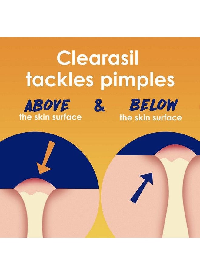 Clearasil كريم علاج حب الشباب العنيد 5 في 1 بأقصى قوة مع 10% من بيروكسيد البنزويل لعلاج حب الشباب 1 أونصة  - Image 4