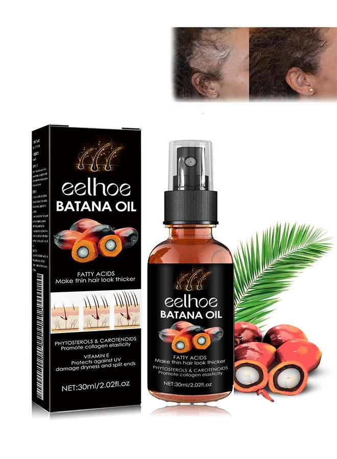 EELHOE Batana Oil，for Hair Growth Batana Oil - Batana Oil Organic for Healthy Hair - Repair Damaged Hair, Nourishes Thin Hair Scalp Skin and Loss Hair Growth Fir for All Hair Types - 30 ml - Image 1
