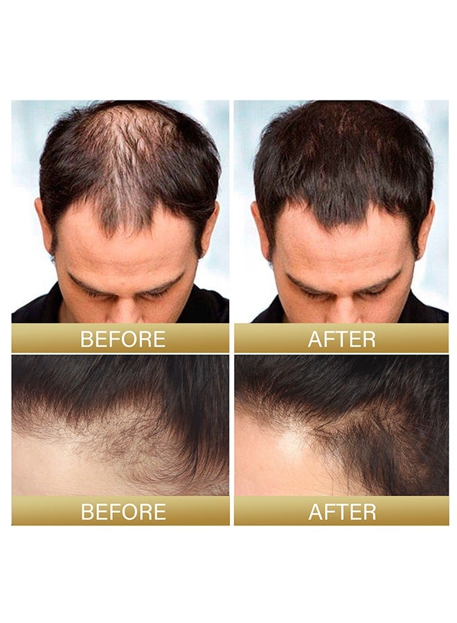 EELHOE Batana Oil，for Hair Growth Batana Oil - Batana Oil Organic for Healthy Hair - Repair Damaged Hair, Nourishes Thin Hair Scalp Skin and Loss Hair Growth Fir for All Hair Types - 30 ml - Image 3