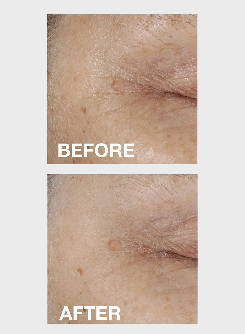Dermalogica Biolumin C Eye Serum