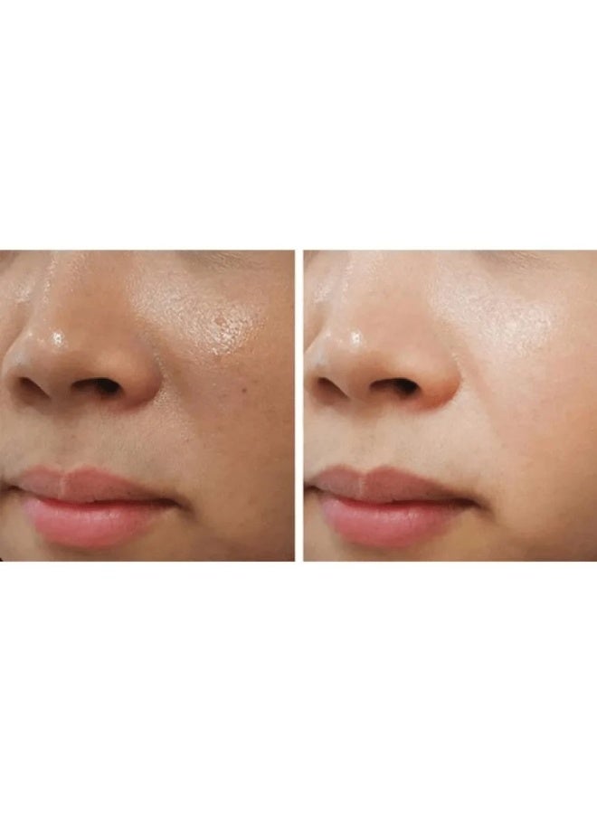 أيه سي أم كريم سيروم ACM لتفتيح البشرة - علاج البقع الداكنة وآثار حب الشباب، تبييض البشرة وتعزيز الإشراقة (فرنسا) - Image 3