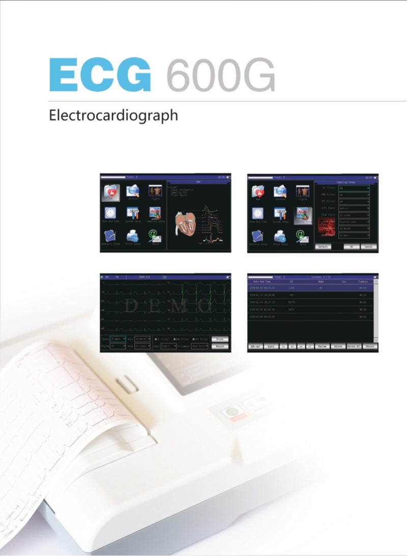 CONTEC جهاز تخطيط القلب الكهربائي الرقمي CONTEC ECG600G ذو 12 سلكًا EKG CE - Image 3