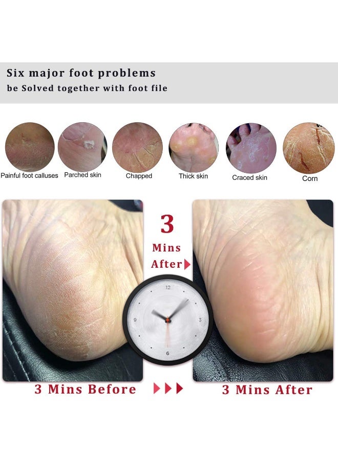 NXT Professional Foot File Foot Scrubber Hard Skin Callus Remover Pedicure Foot Rasp,Can Be use on Cracked Heels,Dead Skin,Corn,Pumice Stone for Feet Massager Scraper File Brush Tools - Image 3