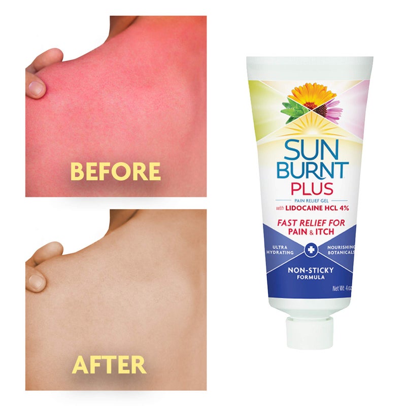 Sunburnt Plus After-Sun Gel with Lidocaine, 4 Ounce - Image 3