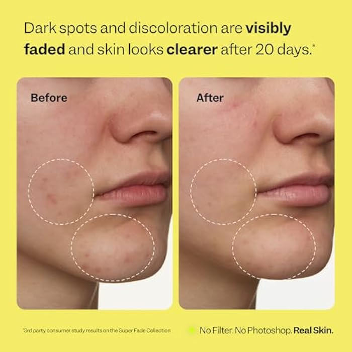 Peach Slices - Super Fade Discoloration Serum for Face (1.01 oz) - Dark Spots, Hyperpigmentation, Uneven Skin - Niacinamide Serum - Tranexamic Acid - Vegan & Cruelty Free - Korean Skin Care & Beauty - Image 4