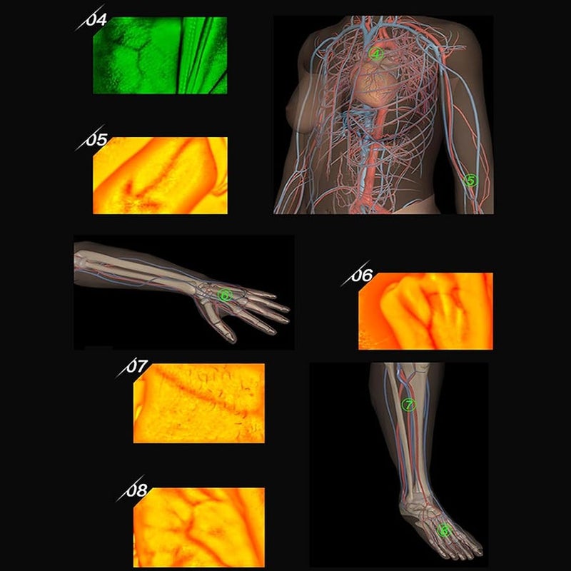 nLn Hope Vein Finder, Portable Blood Vessel Finder, Medical Vein Image Display Instrument, Infrared Vein Finder Viewer Light with 5 Modes for Elderly Adult Children Easy Finding Subcutaneous Veins - Image 5