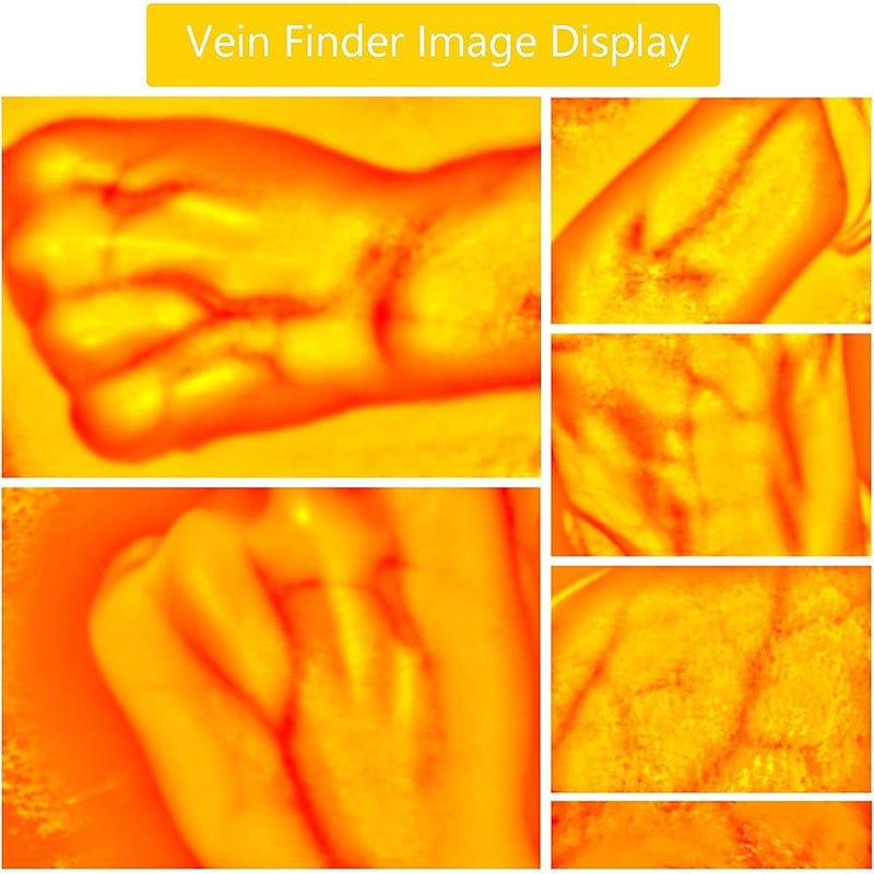 nLn Hope Vein Finder, Portable Blood Vessel Finder, Medical Vein Image Display Instrument, Infrared Vein Finder Viewer Light with 5 Modes for Elderly Adult Children Easy Finding Subcutaneous Veins - Image 2