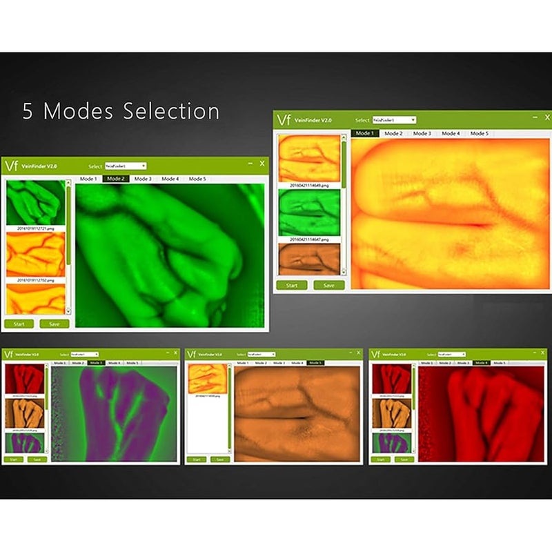 nLn Hope Vein Finder, Portable Blood Vessel Finder, Medical Vein Image Display Instrument, Infrared Vein Finder Viewer Light with 5 Modes for Elderly Adult Children Easy Finding Subcutaneous Veins - Image 3