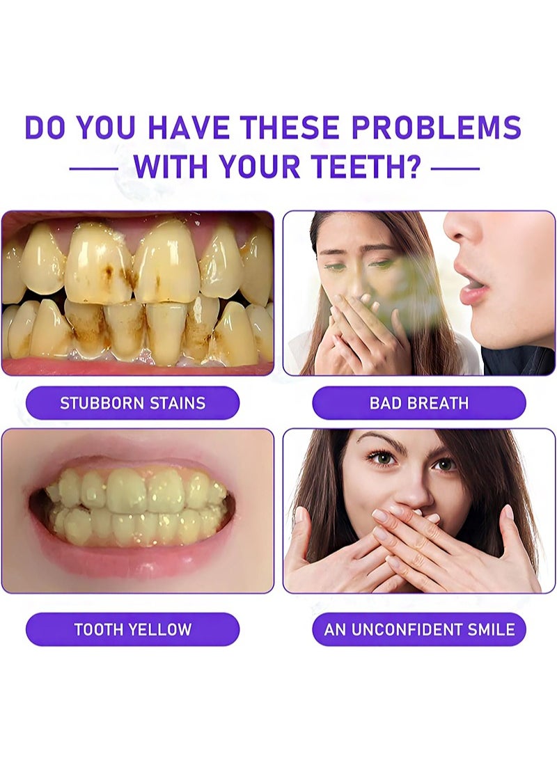 UBESTSMILE Purple Teeth Whitening Pen，Teeth Whitening Gel，V34 Teeth Whitening Pen Kit for Sensitive Teeth，Easy to Use，Brighten Smile，Mess Free Teeth Whitener（3 Pens）  - Image 4