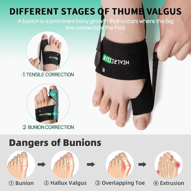 Bunion Corrector Black Toe Straightener - Orthopedic Support Hallux Valgus Corrector for Foot Pain Relief - Image 4