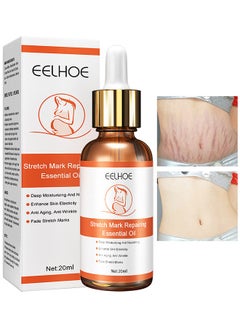 Stretch Mark Repairing Essential Oil, Pure Natural Maternity Skin Care Body Oil Scar Repair Removal Stretch Marks Oil 20ML