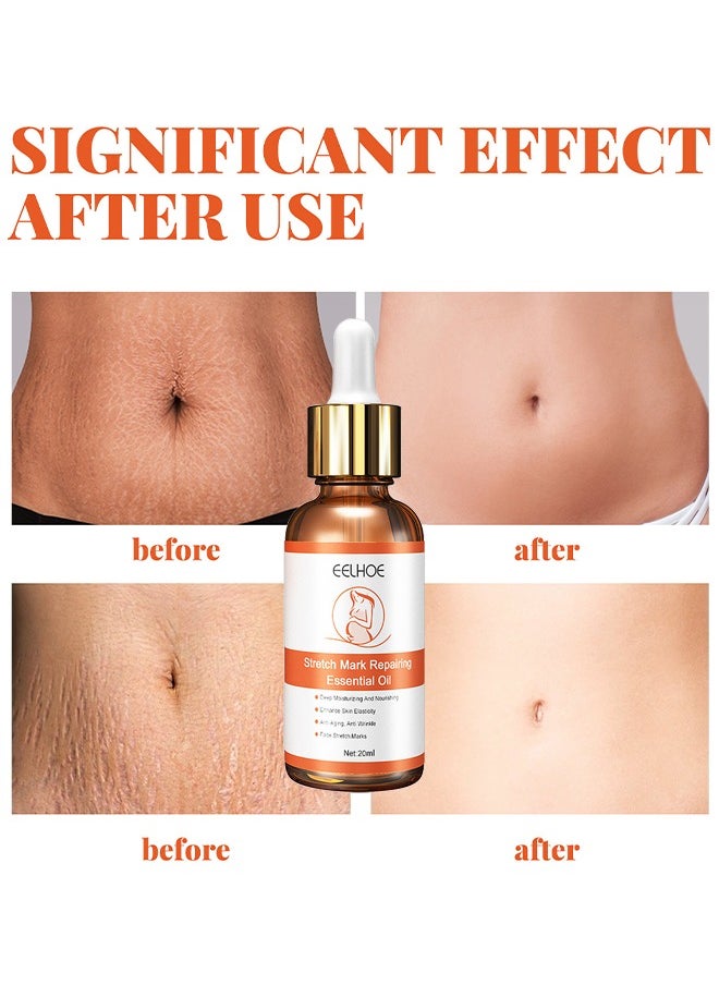 EELHOE - Stretch Mark Repairing Essential Oil, Pure Natural Maternity Skin Care Body Oil Scar Repair Removal Stretch Marks Oil 20ML - Image 1