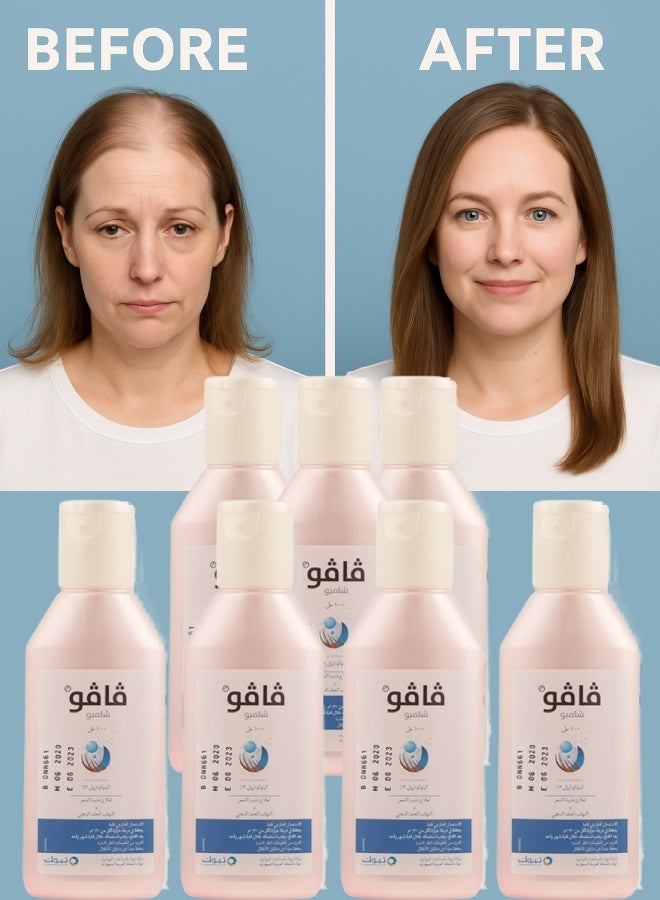 فافو 7 قطع فافو 2% شامبو 100مل - Image 1