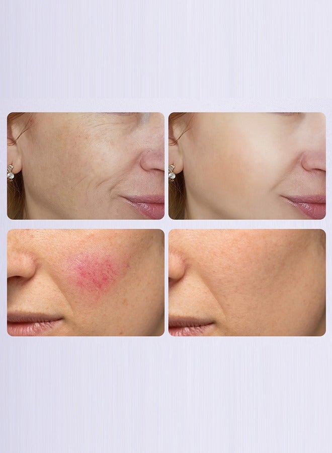 Kojic Acid Face Cream 50g,Deep Nourishment Anti Wrinkle Firming Repair Skin Barrier, Improve And Repair Damaged Skin Mildly Whiten Fix Wrinkles, Spots Or Acne Scars In A Effective Way - Image 5