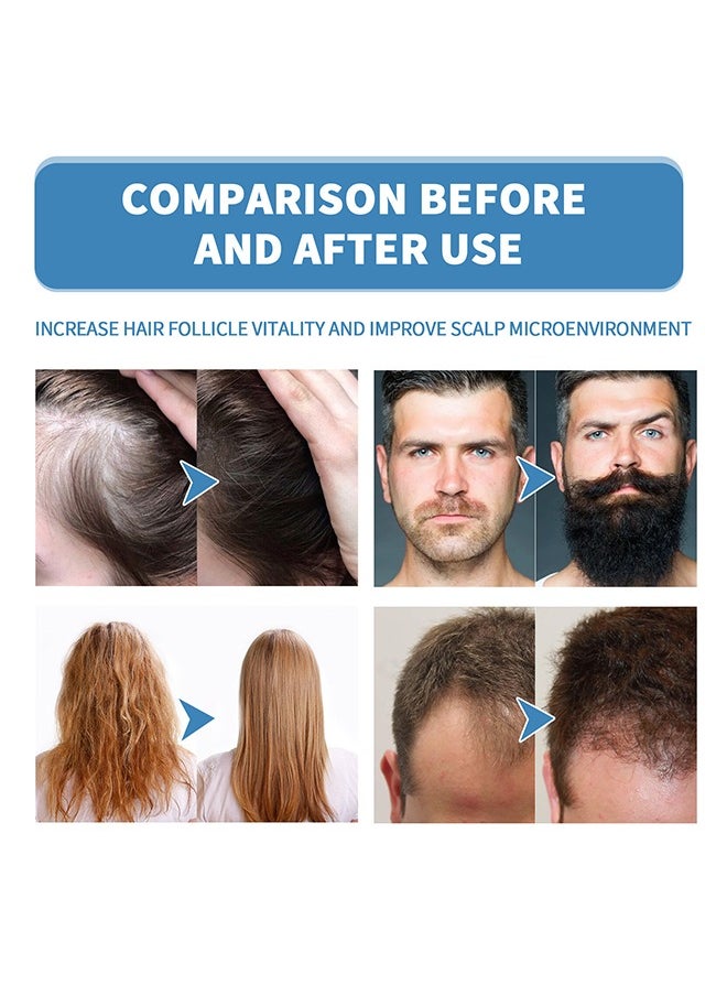 East Moon - Minoxi Roll-on Beard Treatment Man Beard Growth Oil 18ml, Roll-on Thick Hair Oil, Moisturizing And Strengthening Hair, Fixing Hair, Repairing Hairline And Thick Hair - Image 1