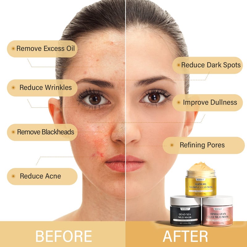 YLNALO 3 Pcs Clay Facial Mask Set - Turmeric Vitamin C, Dead Sea and Himalayan Clay Skin Care Mask for Deep Cleansing, Moisturizing, and Refining Pores, Spa Facial Mask Set, Face Mask Gift Set - Image 2