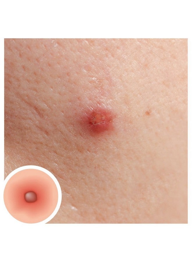 Vegetal Tea Tree Face Wash Made Of 100% Natural Extracts Of Green Tea Neem Manjistha & Khajoor Anti Acne Oil Control Free Of Parabens Sles & Harmful Chemicals - Image 4