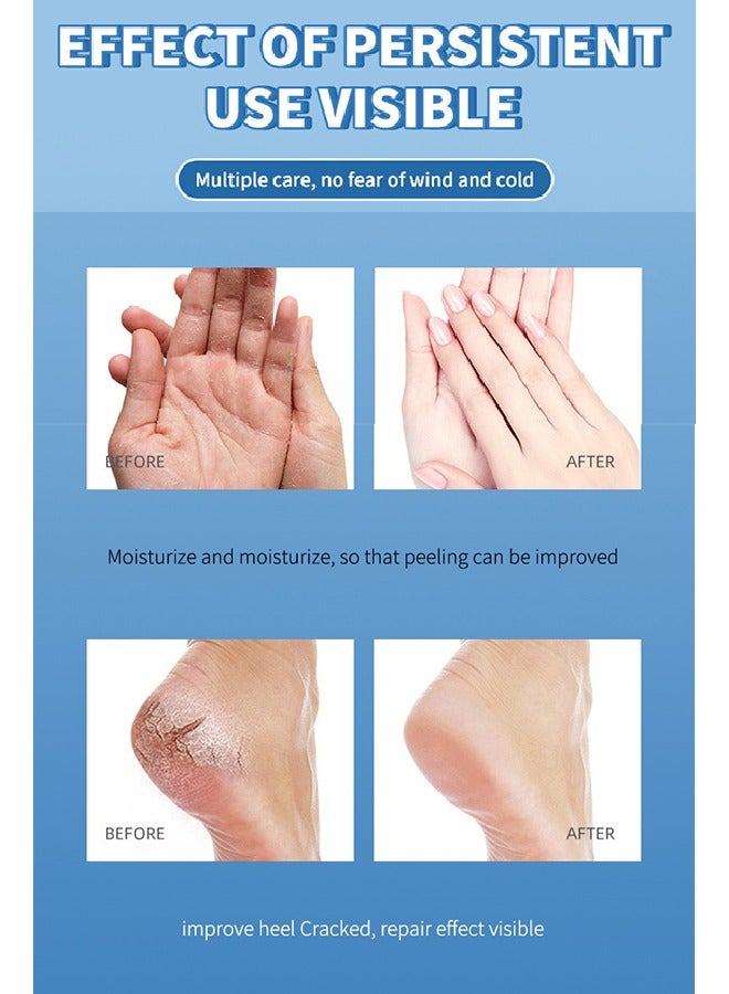 OCHEAL Anti Cracking Petrolatum Moisturizing Ointment Anti Crack Care Cream - Drying Anti Crack Care Cream for Foot Hand and Lips Cracked Repair Body Cream Cracked Feet Cream Repair and Softens Skin Moisturizer 40g - Image 4