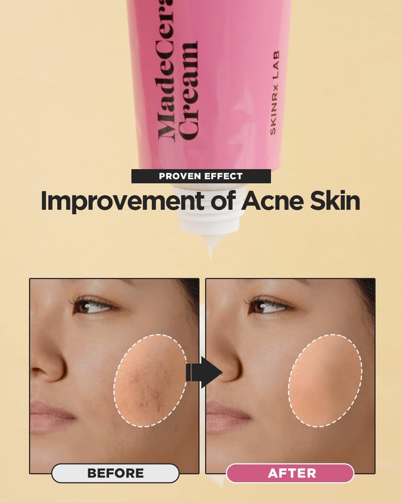 BEISIKS SKINRxLAB Made Cera Cream - Acne & Redness Relief Face Moisturizer, Sebum Control, Improving Skin Barrier with Ceramide and Madecassoside, Anti-Aging and Pore Minimizing Face Cream, 1.69 fl.oz. - Image 3
