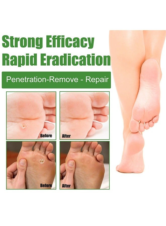 إيلهو 30 جهاز كمبيوتر شخصى منصات إزالة الثآليل ، علاج تخفيف آلام الذرة والعناية بالقدم ، بقع نظيفة مضادة للصداغ ومضادة للبكتيريا - Image 5