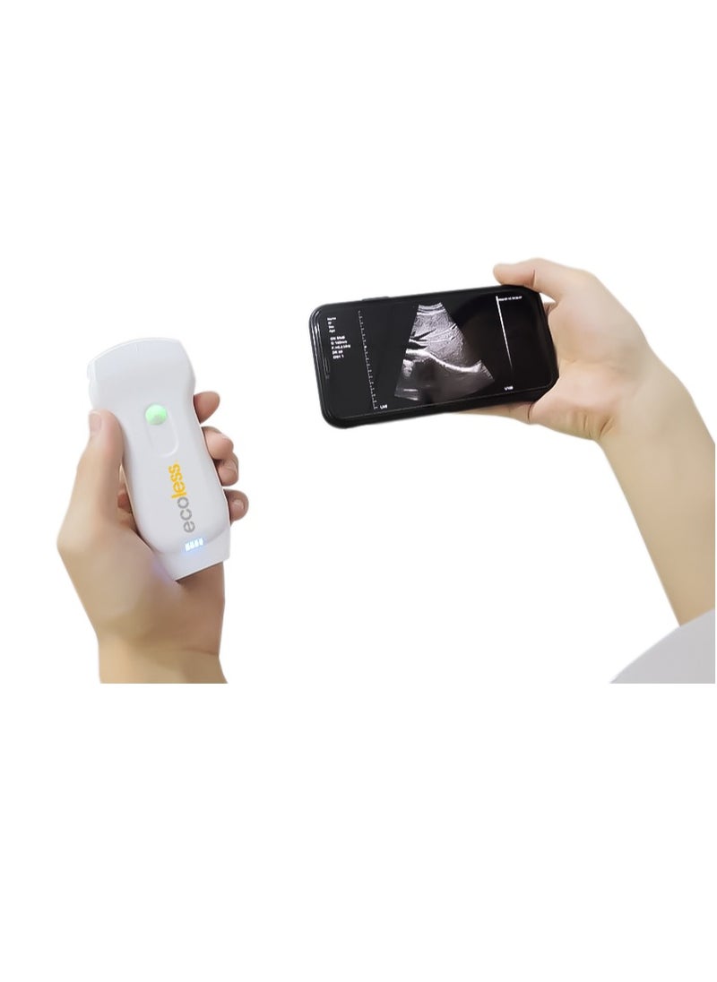 ABRONN Ecoless 3-in-1 Ultrasound Probe (EL-CL21A1) 640104, Multi-Function Imaging, High-Resolution, Compatible with Ultrasound Systems, Lightweight, Durable, Ideal for Vascular, Musculoskeletal, and Abdominal Imaging  - Image 2