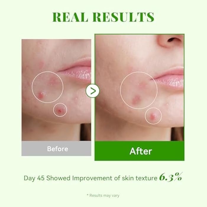 ANAI RUI Exosome Cica Serum,Exosomes for Skin, with Hyaluronic Acid,Soft Skin, Glass Skin,Low-irritating, Moisturizing 1.05 Fl.oz - Image 4