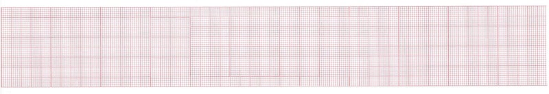Quality Chart Paper Contec 80A ECG Chart Paper, 50mm X 20m - 10 Rolls - Image 2