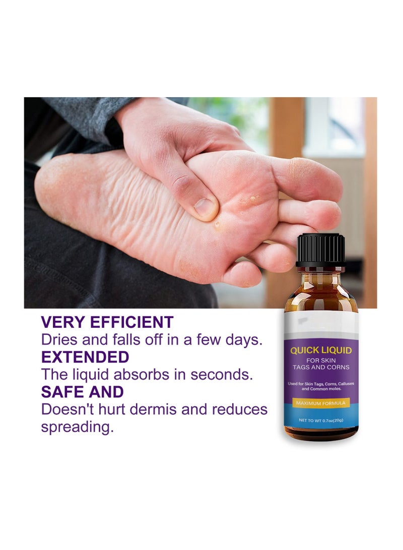 Quick Liquid for Remove Warts Remove Moles and Smooth Skin - Image 5