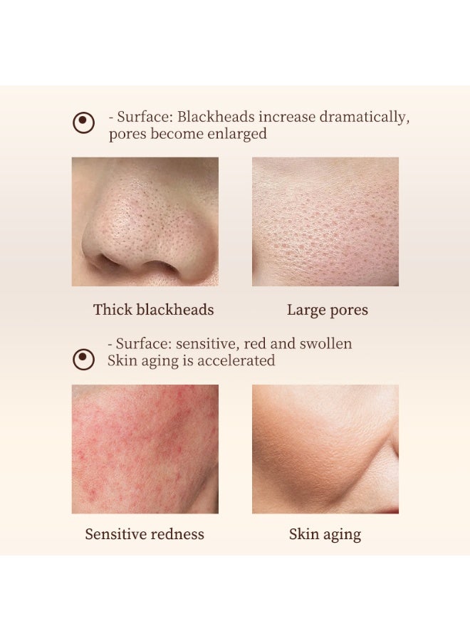 LYDIMOON Lactobionic Acid Repair Serum, Pore Shrinking & Blackhead Remover 30ml - Image 3