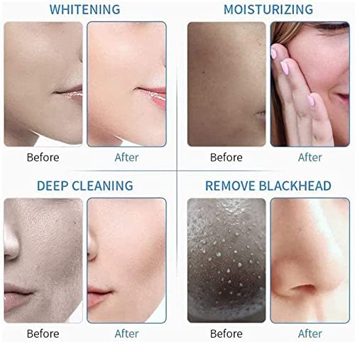 ACi 7 In 1 Hydrafacial Machine Muscle Massage Device(Double Motor)|Hydrodermabrasion Machine|Hydra Facial Microdermabrasion Machine|Deep Clear Hydrofacials Machine For Salons/Parlour&Skin Clinics - Image 5