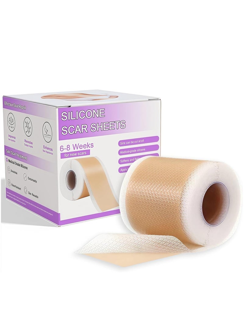 Generic Scar Roll Sticker，Fade Scar Sticker，Self-Adhesive Scar Removal Sticker ，Efficient Beauty Scars Removal Silicone Gel Skin Tone 4CM*1.5M  - Image 1