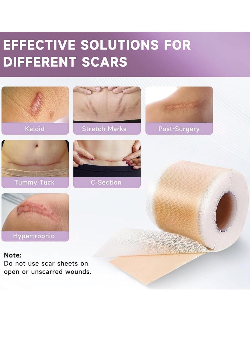 Generic Scar Roll Sticker，Fade Scar Sticker，Self-Adhesive Scar Removal Sticker ，Efficient Beauty Scars Removal Silicone Gel Skin Tone 4CM*1.5M  - Image 2