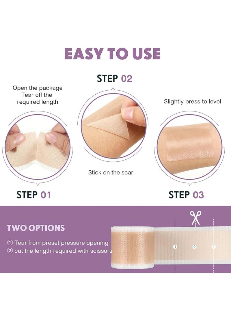 Generic Scar Roll Sticker，Fade Scar Sticker，Self-Adhesive Scar Removal Sticker ，Efficient Beauty Scars Removal Silicone Gel Skin Tone 4CM*1.5M  - Image 4