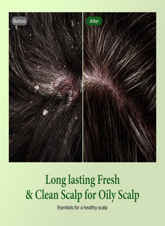 كاندال شامبو كوندال للتنظيف العميق بخلاصة شجرة الشاي والمكاديميا - عناية كورية بالشعر وفروة الرأس، بخلاصة شجرة الشاي، لجميع أنواع الشعر، 10.14 أونصة سائلة لكل عبوة (عبوة من قطعتين) (بودرة أطفال) - Image 2