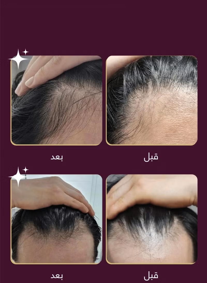 Wins Town Revive Therapy Hair Scalp & Brow Ampoule 15ml - Image 2