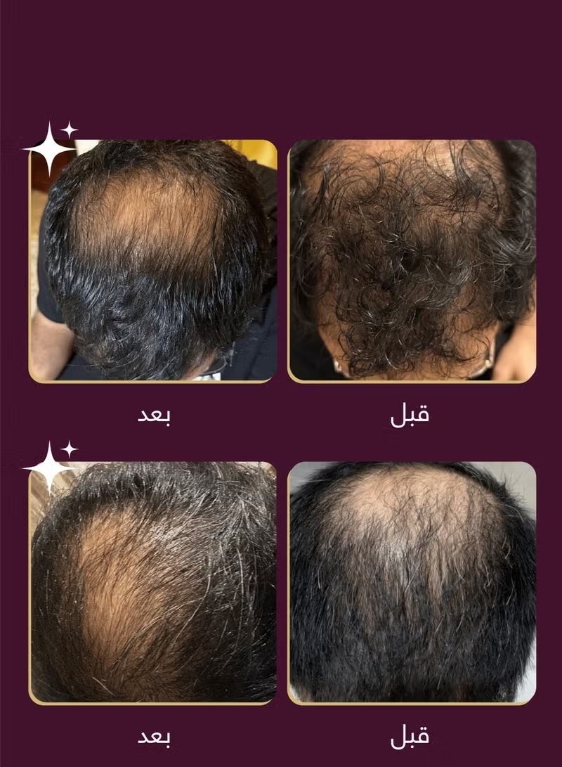 Wins Town Revive Therapy Hair Scalp & Brow Ampoule 15ml - Image 4