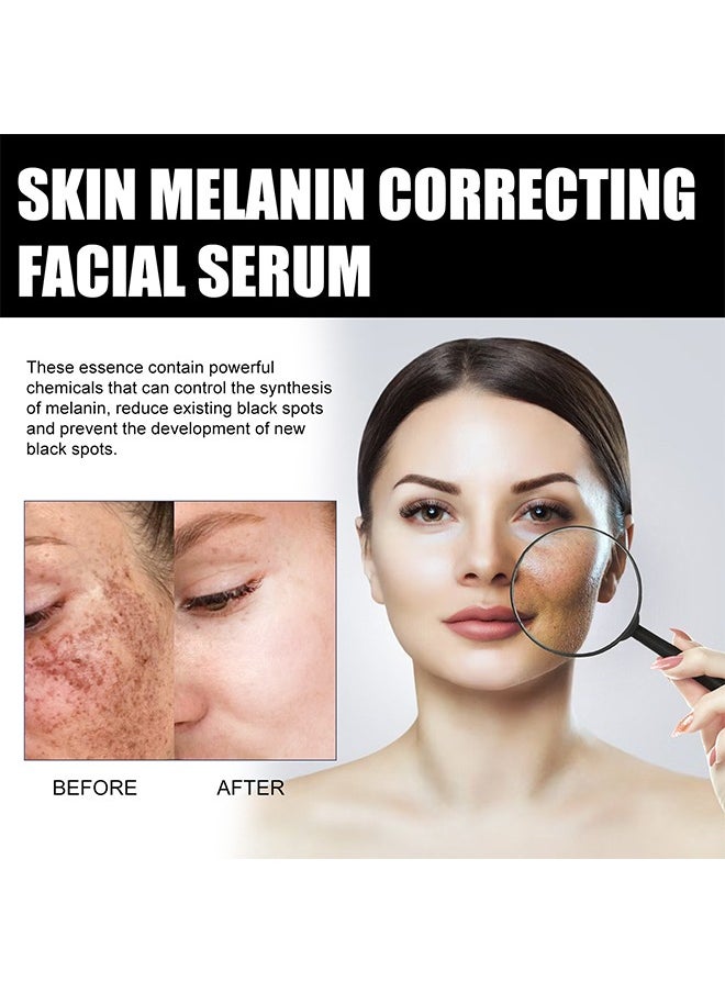 EELHOE - Skin Melanin Correcting Facial Serum, Dark Spot Correcting Glow Serum, Mild And Not Stimulating For Any Part - Image 1