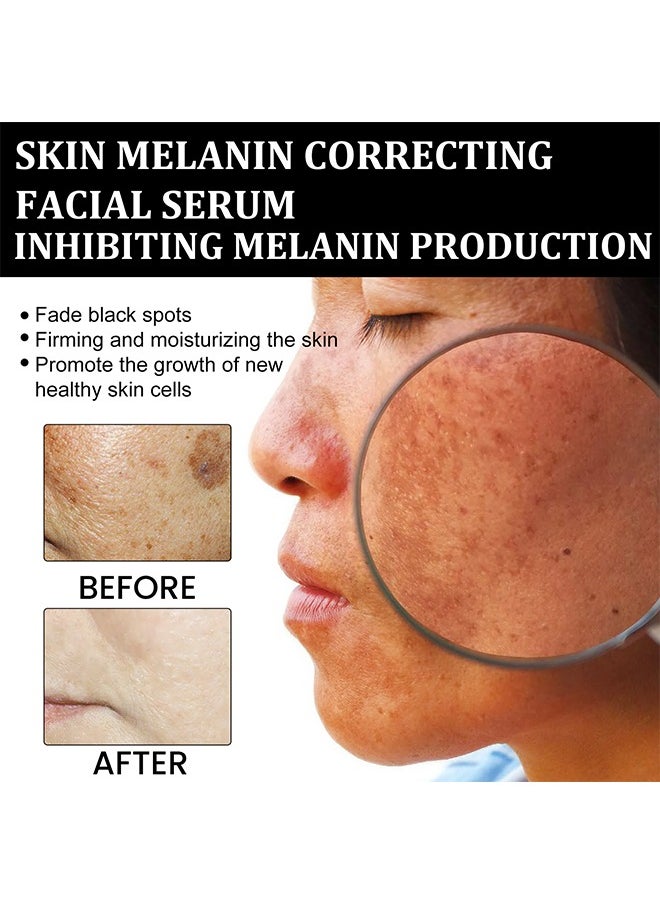 EELHOE - Skin Melanin Correcting Facial Serum, Dark Spot Correcting Glow Serum, Mild And Not Stimulating For Any Part - Image 1