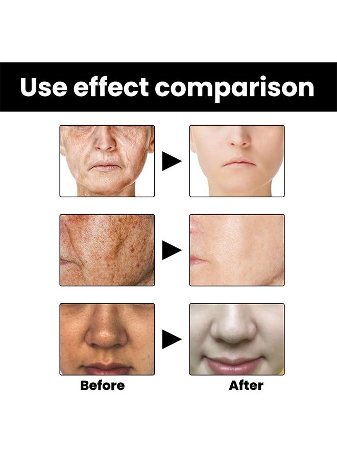 EELHOE - Skin Melanin Correcting Facial Serum, Dark Spot Correcting Glow Serum, Mild And Not Stimulating For Any Part - Image 1
